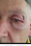 shiner.PNG